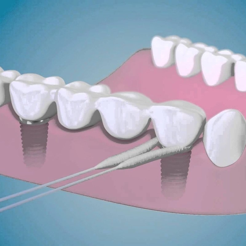 نحوه استفاده از نخ دندان SUPER FLOSS اصل ارس یاب