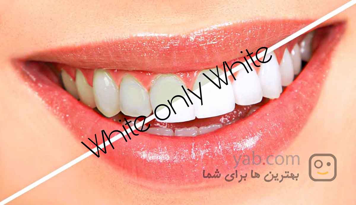 خمیر دندان سفید کننده W.O.W پروکسین حاوی روغن نارگیل ۱۰۰٪ اورگانیک 